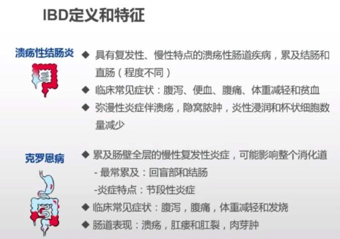 强生特诺雅达®在华上市 用于部分成人克罗恩病和溃疡性结肠炎