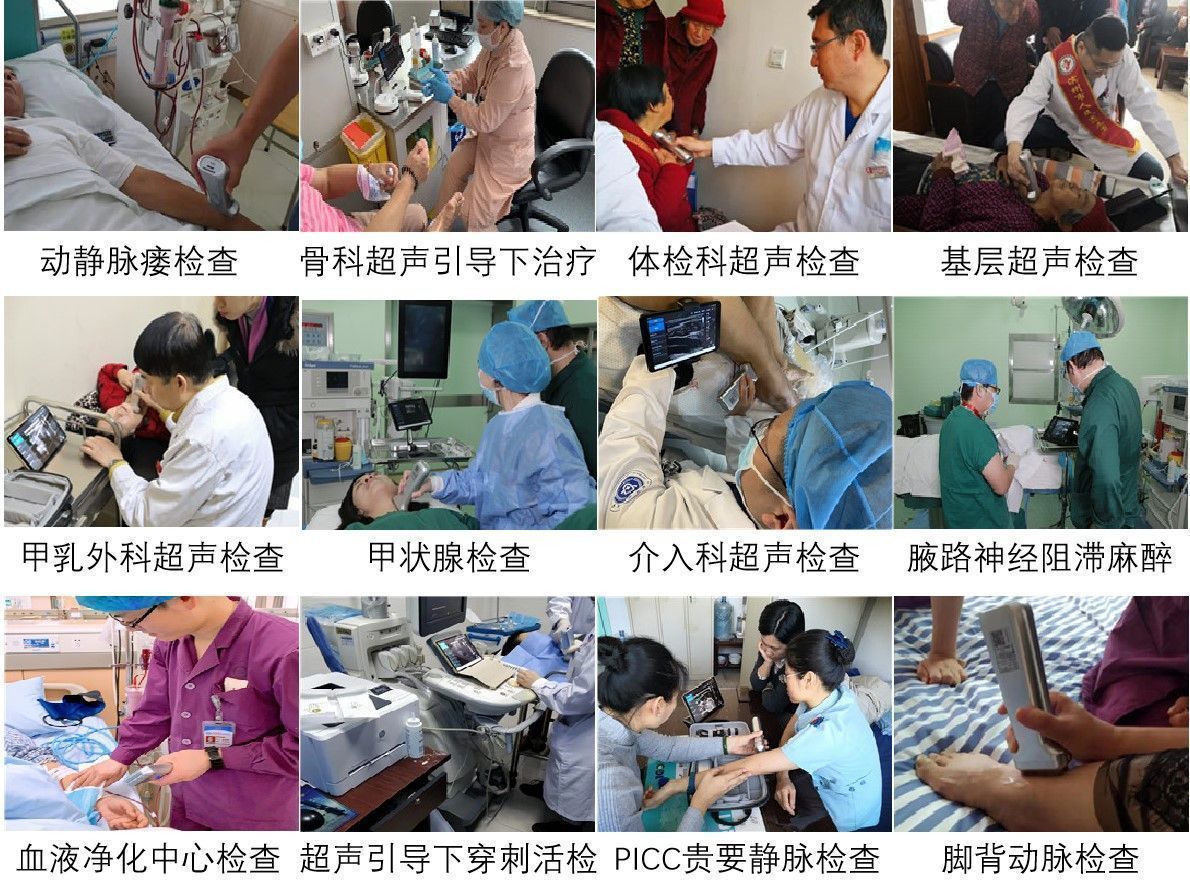 华大智造掌上超声诊断仪EF6系列获批中国医疗器械注册证