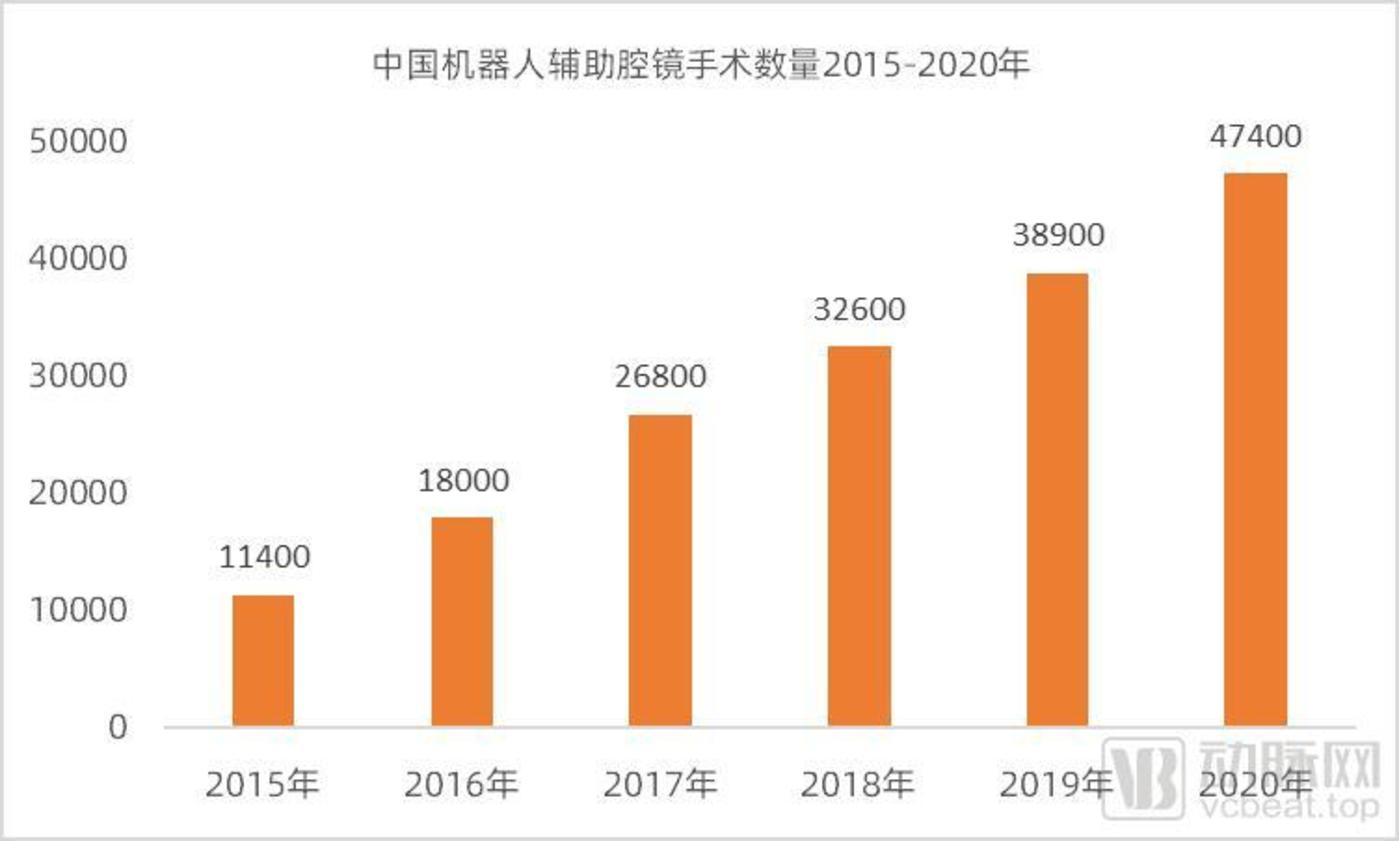 斯坦德机器人冲刺IPO,3年累计亏损2.73亿元,面临激烈的竞争