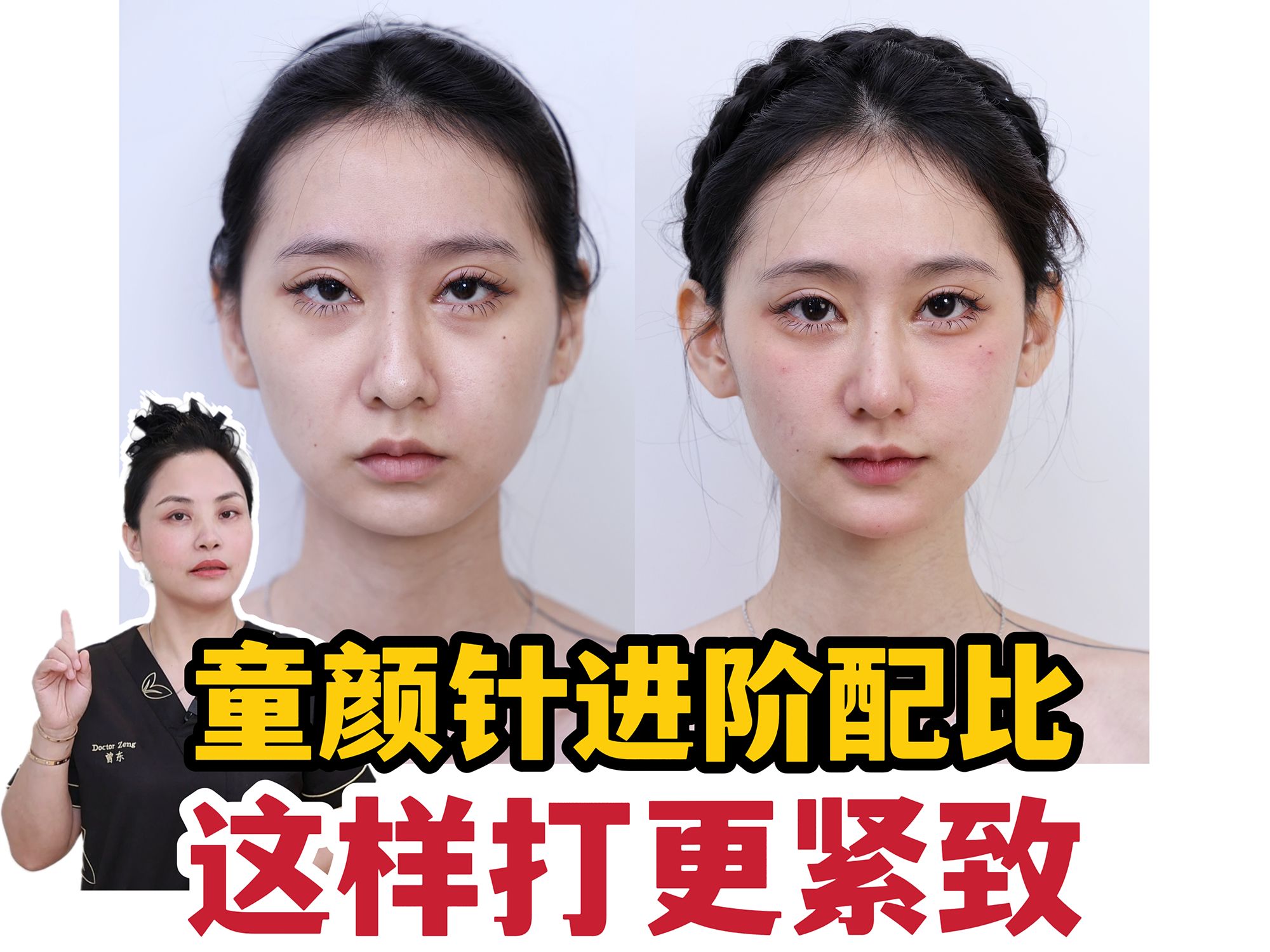 争夺艾塑菲中国代理权,谁更需要“童颜针”