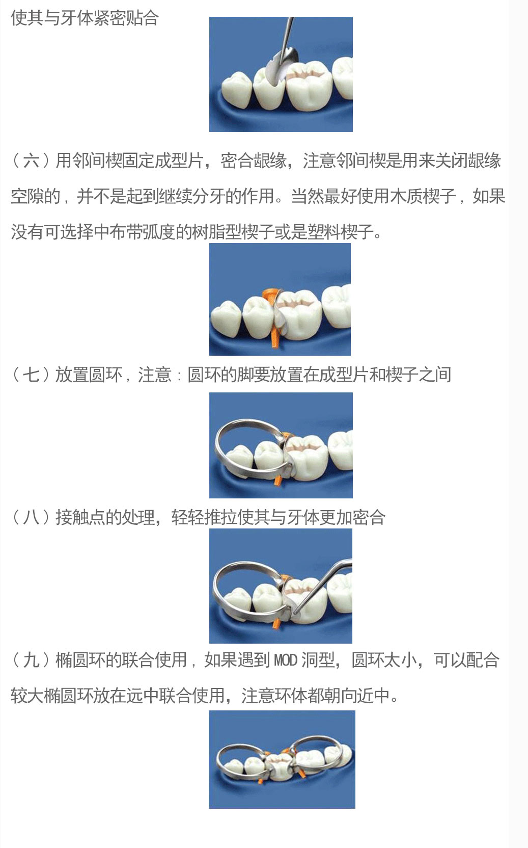 全球牙科龙头登士柏被指以次充好 或涉8万余患者